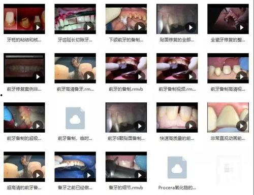 水莓100免费视频